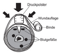 Druckverband anlegen